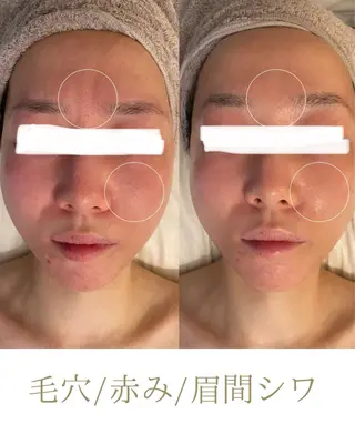 田中For..天王寺 肌質改善/よもぎ蒸しのエステ・リラクイメージ