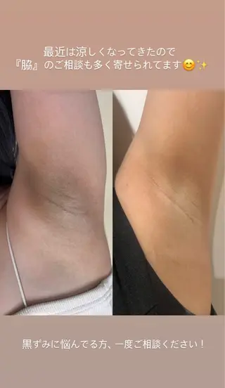 エステサロン-mignon-所属・mignon 脱毛/ ローマピンク/耳ツボのその他イメージ