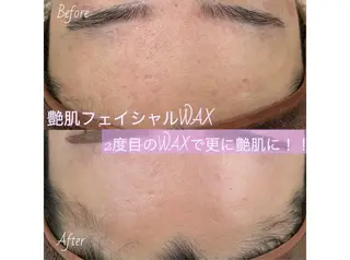 chou cherie所属・🌈肌質改善サロン. manami🌈のエステ・リラクイメージ