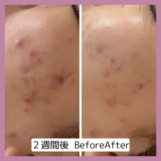 【現役看護師】高来 笑子のエステ・リラクイメージ