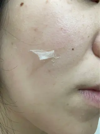 clé skin 🌿ハーブピーリングのエステ・リラクイメージ