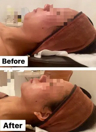 Remina clinical salon所属・ハイフ美肌専門 Remina.c.sのエステ・リラクイメージ