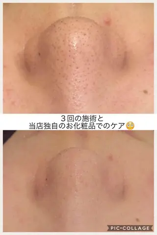 ミディアム カラー パーマ ヘアアレンジ メンズ キッズ ネイル マツエク・マツパ ニキビ・肌質改善専門 ♡人生が変わるサロンのエステ・リラクイメージ