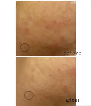 美まつ毛と美肌サロン lavjuのマツエク・マツパデザイン