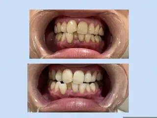 salonSHE° 新宿店🩵NINAのエステ・リラクイメージ