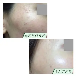 ハーブピーリング・毛穴ケア専門サロンSalon de LENA所属・ハーブピーリング 専門店/名古屋駅前店のその他イメージ