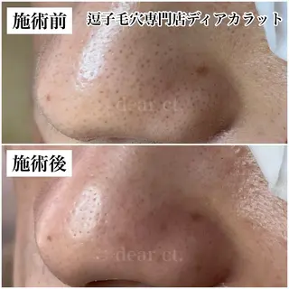 毛穴専門店　dear Ct.所属・毛穴専門店 ディアカラットのエステ・リラクイメージ