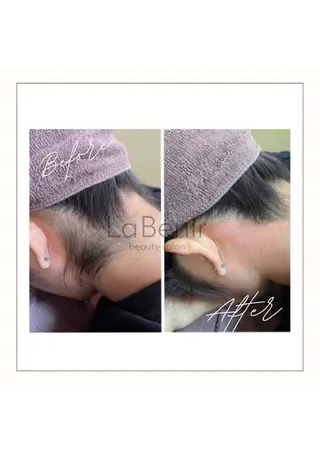 脱毛/美肌【皮膚科看 護師経営】ラベニールのエステ・リラクイメージ