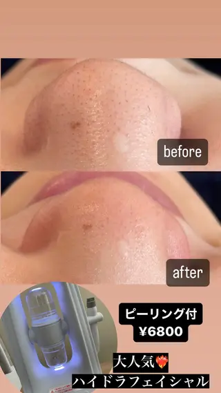 VERY VERY九条店所属・VERY VERY 九条店のエステ・リラクイメージ