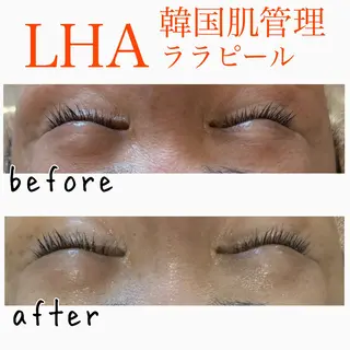 美肌脱毛と癒しのﾌﾟﾗｲﾍﾞｰﾄｻﾛﾝ。gratia~ｸﾞﾚｲﾃｨｱ~所属・gratia ~ｸﾞﾚｲﾃｨｱ~のエステ・リラクイメージ