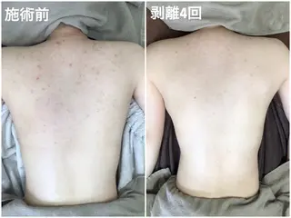 ハーブピーリング専門 エミルカ船橋のエステ・リラクイメージ