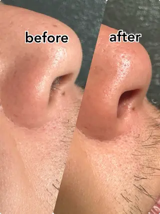 マルサンカクシカク所属・○△□ 守口市のネイルデザイン