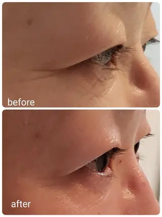 20代からのツヤ肌 サロン　シャルマンのエステ・リラクイメージ