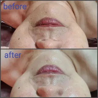 顔ツボ整顔セラピスト 三根百恵のエステ・リラクイメージ