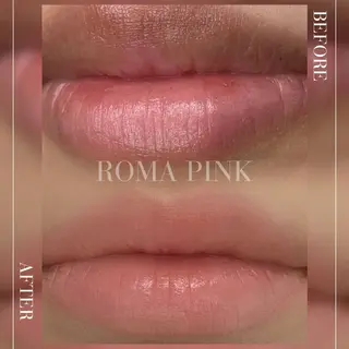 小顔/たるみ/黒ずみ除去専門サロン/SONA 大和西大寺店所属・【小顔専門看護師 サロンSONA】のエステ・リラクイメージ