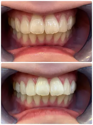 ダイヤモンドホワイトニング渋谷所属・DIAMOND BEAUYのその他イメージ