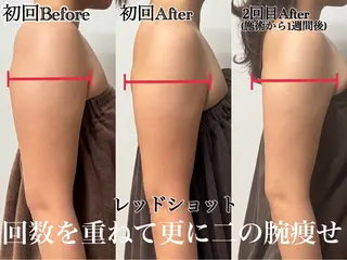 六本木脱毛andS さおりのエステ・リラクイメージ