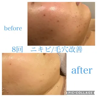 ロング カラー パーマ ヘアアレンジ メンズ ネイル マツエク・マツパ Ensor Clair所属・EnsorClair 代表　野口真央のエステ・リラクイメージ