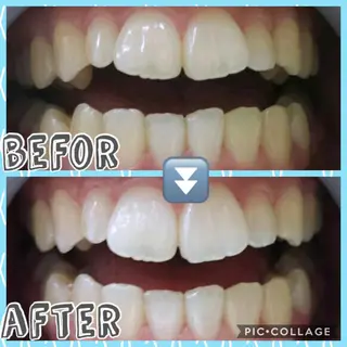 self whitening  BIOLUS所属・whitening BIOLUSのその他イメージ