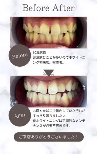 エクシアホワイトニング平岸店所属・𝒀𝑼𝑰 店長⋆𝜗𝜚のその他イメージ