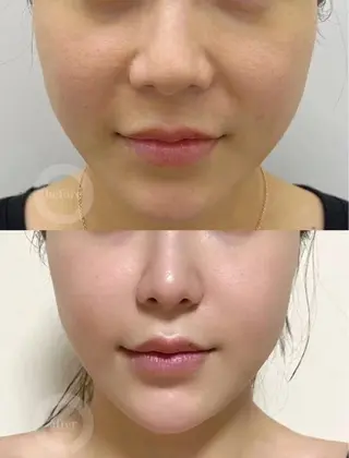 マツエク・マツパ aliaハイフ&水光ジェットサロン所属・aliaハーブ水光店 エステティシャン募集のエステ・リラクイメージ