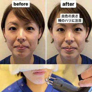 むくみたるみ専門☆ 美容鍼・小顔矯正のエステ・リラクイメージ