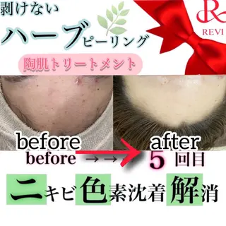 laluna saki...のその他イメージ