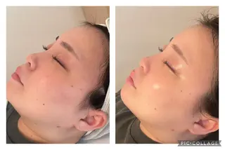 美肌サロン　ナゴミプラス所属・美肌とヘッド　和み+ 福　千賀子のエステ・リラクイメージ