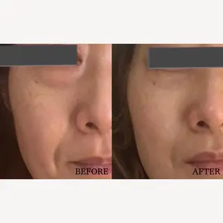 BUB PIBのエステ・リラクイメージ