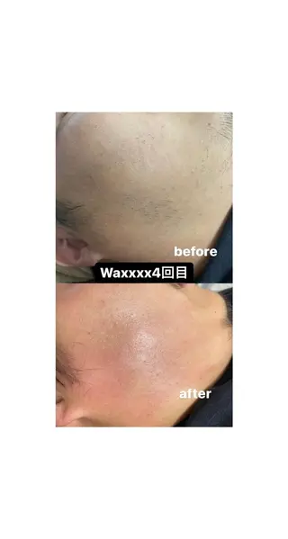 メンズ Epina 千葉店 【エピナ】のエステ・リラクイメージ