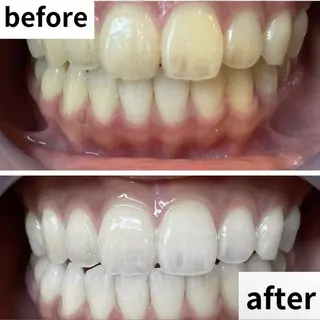 LBSホワイトニング 🌐渋谷店 小河原のエステ・リラクイメージ