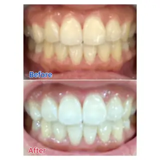 MBEAUTYSALON 千葉店・京成大久保所属・Melty 輝のその他イメージ