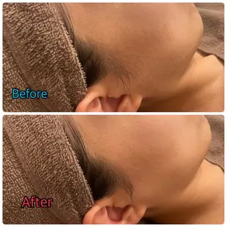 銀座八 レディースシェービング所属・相馬朋美 銀座八のエステ・リラクイメージ