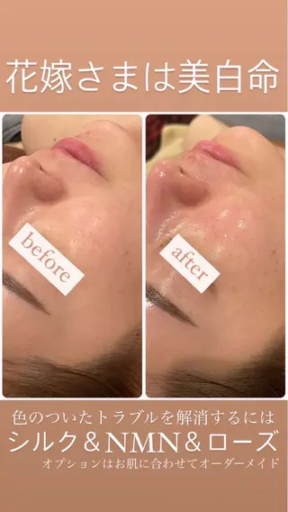 立体小顔×艶肌×美ボ ディ似合わせ施術 岡のエステ・リラクイメージ