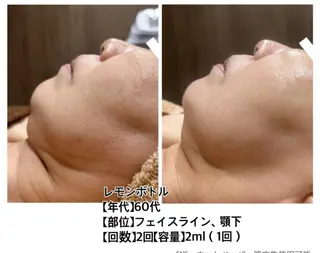 ベルーテ エッセンスのエステ・リラクイメージ