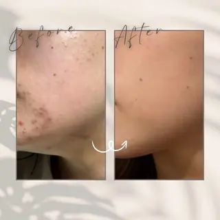 Toujours所属・Toujours トゥジュールのエステ・リラクイメージ