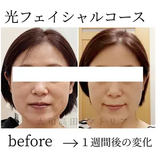 小顔と美肌 まごころエステMatoria所属・小顔 美肌専門 Matoriaのエステ・リラクイメージ