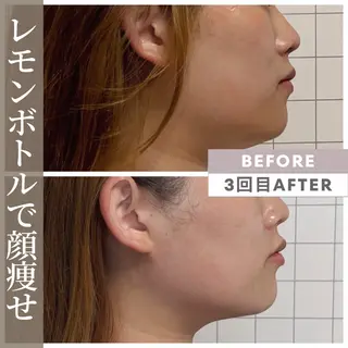 小顔矯正専門店 【RED】池田のエステ・リラクイメージ