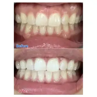 M渋谷店所属・M渋谷 ホワイトニングのその他イメージ