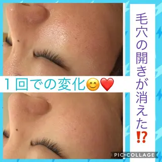 ミディアム カラー パーマ ヘアアレンジ メンズ キッズ ネイル マツエク・マツパ ニキビ・肌質改善専門 ♡人生が変わるサロンのエステ・リラクイメージ