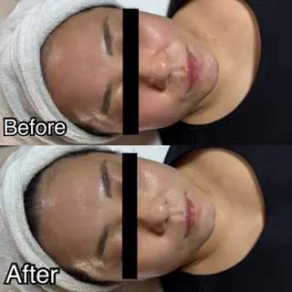 ROR所属・ROR nailのエステ・リラクイメージ