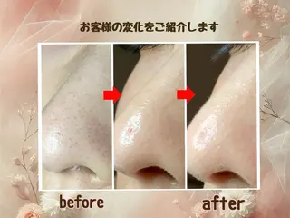 小顔矯正&美肌サロン ブプラ大元駅前店のエステ・リラクイメージ