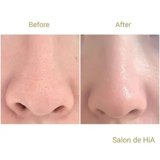 Salon de  HiAのエステ・リラクイメージ