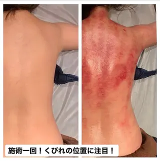 セルライトクラッシュ ＆腸もみ＋骨盤矯正のエステ・リラクイメージ