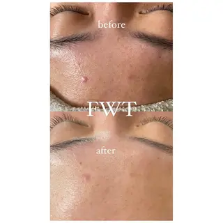 デコパーツが得意♪ ネイル/眉毛/エステの眉毛・アイブロウイメージ