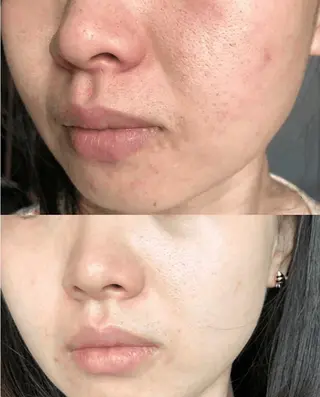 ネイル 愛維美水光美肌専門店所属・愛維美水光美肌専門店 メンズレディースokのエステ・リラクイメージ