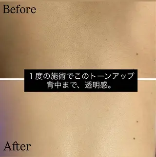 脱毛専門店《横浜•馬車道店》肌質改善所属・【都度払い脱毛】毛穴 専門サロン  馬車道のエステ・リラクイメージ