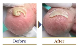 巻き爪補正店 横浜関内店のネイルデザイン