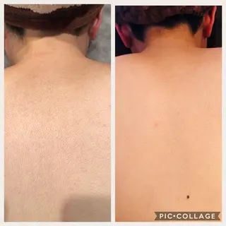 INFINITY 神戸店のエステ・リラクイメージ