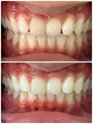 プラチナムビューティー武蔵小山店所属・プラチナム ビューティー武蔵小山のその他イメージ